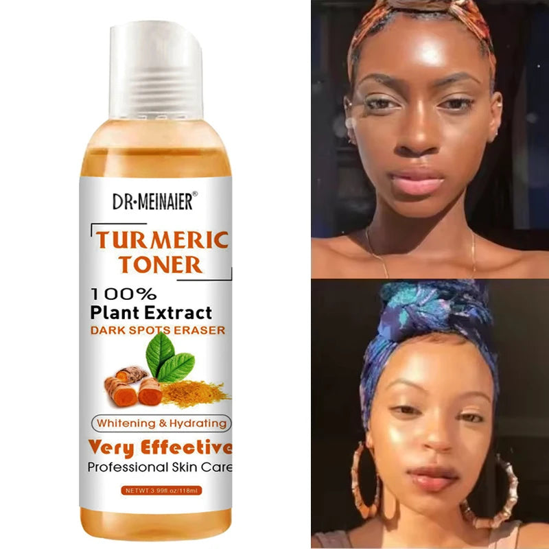 Turmeric Vitamin C Brightening Serum – Dark Spot Corrector